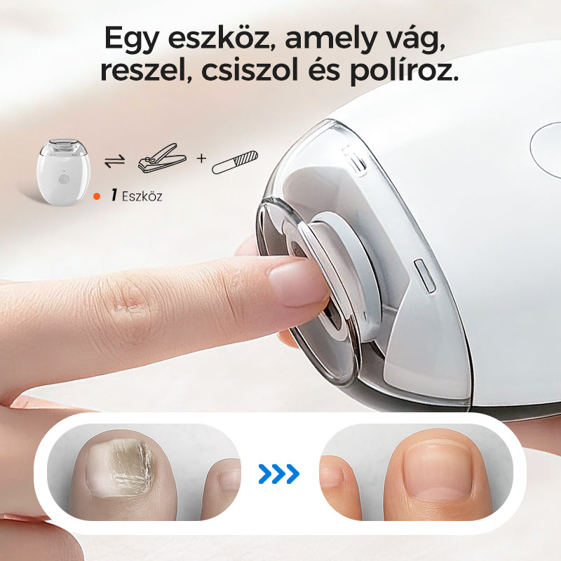 【🔥1+1 ingyenes】💅Automatikus körömreszelő