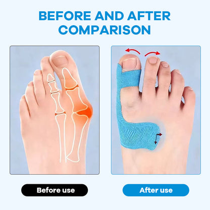 👣Előre kivágott hallux valgus korrekciós kineziológiai tapasz